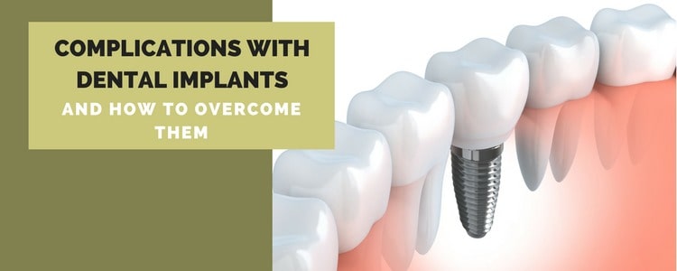 Complications With Dental Implants And