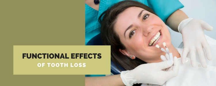 Effect of Tooth Loss