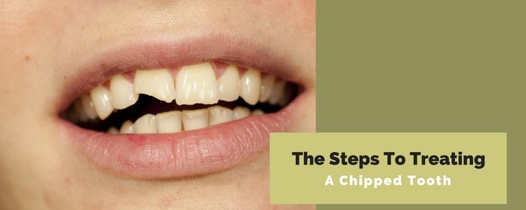 Treating A chipped tooth