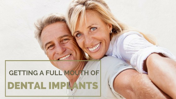 getting a full mouth of dental implants