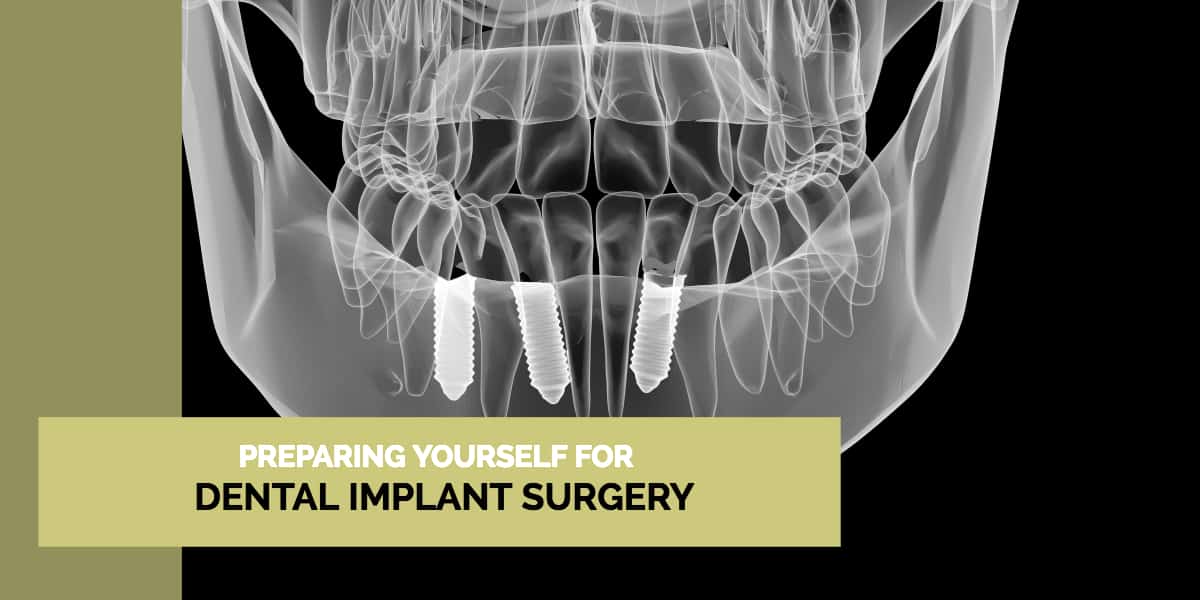 preparing yourself for dental implant surgery