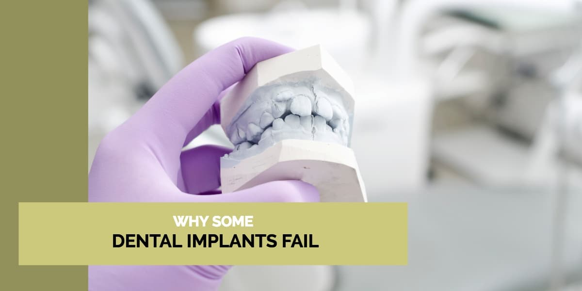 why some dental implants fail