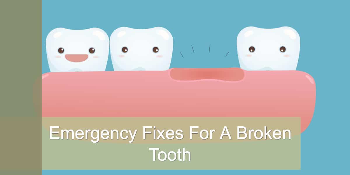 Emergency Fixes For A Broken Tooth