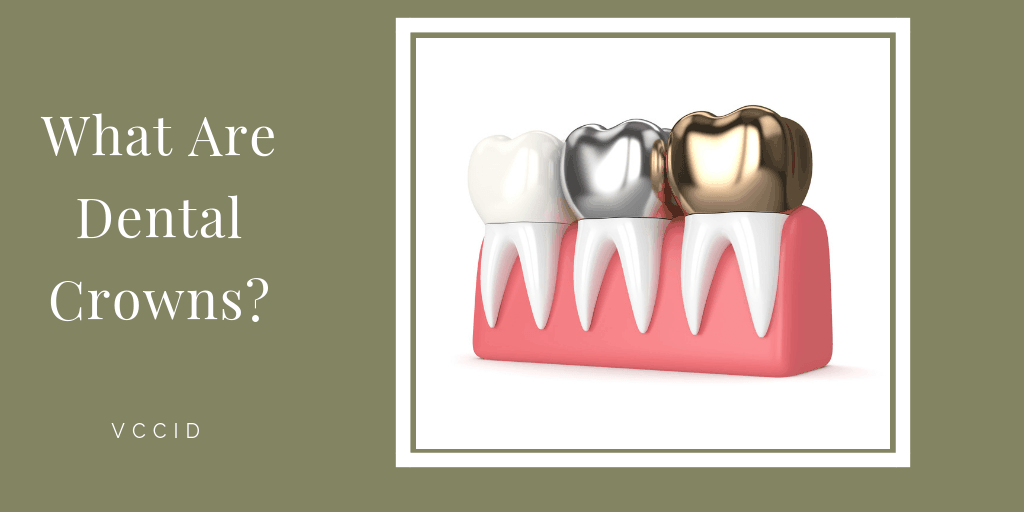 various dental crowns on teeth