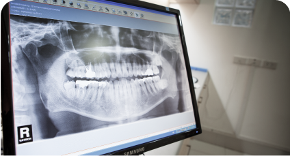 A photograph showing the type of fully digital, low-toxicity approach that patients receive with VCCID's holistic dental care in Burnaby