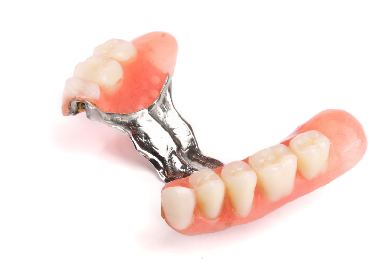 An image showing an example of partial dentures in Burnaby provided at VCCID