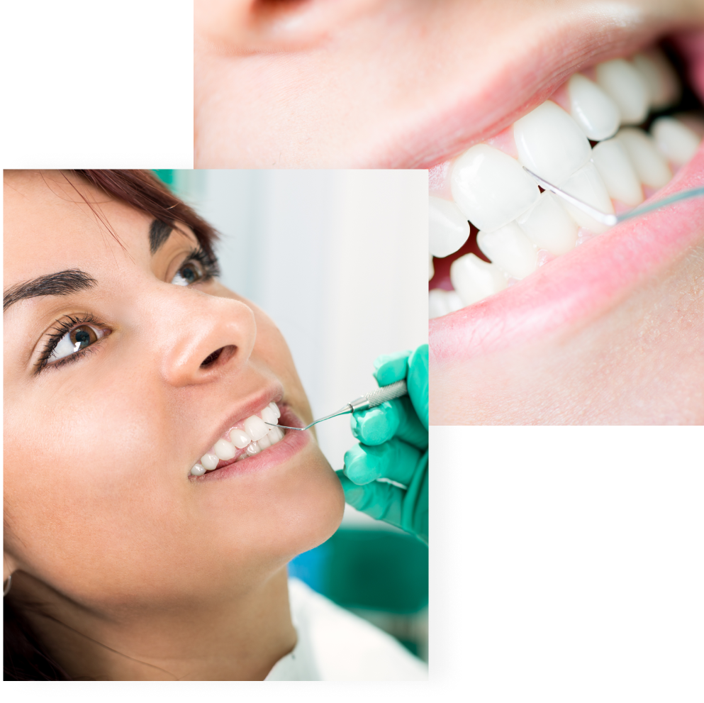 A pair of photographs featuring a young woman and a close-up of her smile, showing how treatments like dental bonding in Burnaby at VCCID can help to correct tooth damage and conceal persistent blemishes