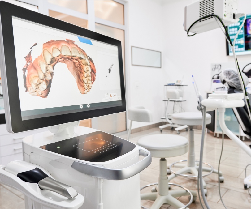 The digital results of a CBCT scan being displayed on a large monitor in a dental treatment room