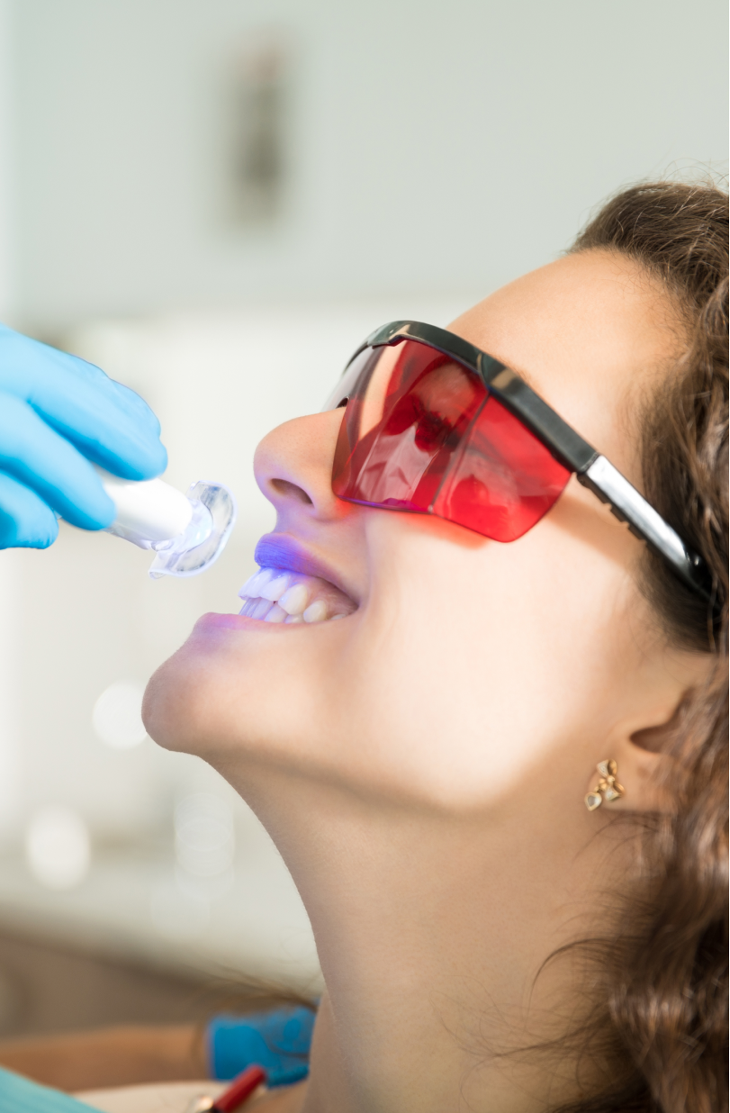 An image of a young woman undergoing a teeth whitening treatment similar to VCCID's options for teeth whitening in Burnaby